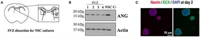 Angiogenin in the Neurogenic Subventricular Zone After Stroke